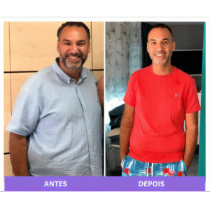 gastroplastia endoscopica em porto alegre dr nelson coelho urgegastro